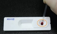 首尔市明年推出快速检测艾滋病服务 20分钟出结