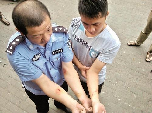艾滋男咬交警