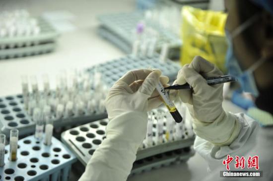 探秘重庆医院艾滋病筛查、确认实验室。中新社记者 陈超 摄