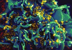 HIV 病毒能快速突变逃过 CRISPR 掌控